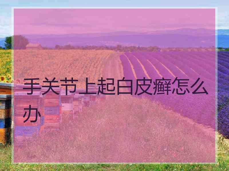 手关节上起白皮癣怎么办